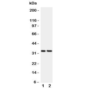 Anti-CD20