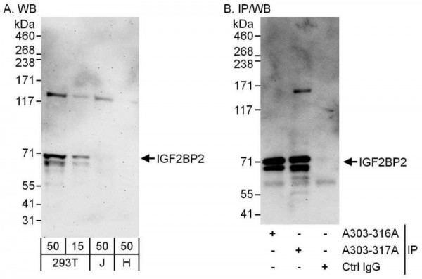 Anti-IGF2BP2