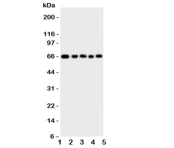 Anti-MBD4