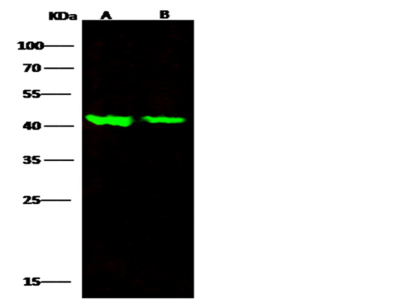 Anti-ALK-1/ACVRL1 Monoclonal Recombinant Antibody