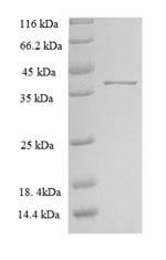 Zinc transporter ZIP13 (Slc39a13), partial, rat, recombinant