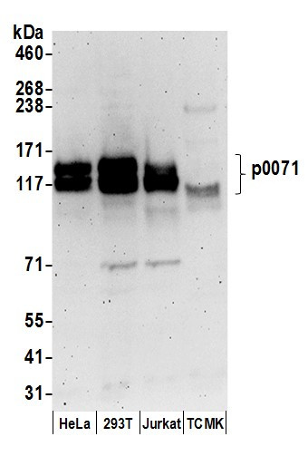 Anti-p0071