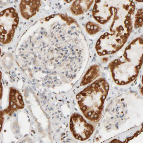 Anti-FMO1