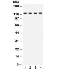 Anti-NKCC2 / SLC12A1