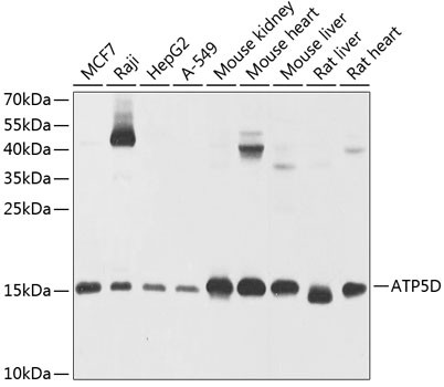 Anti-ATP5D