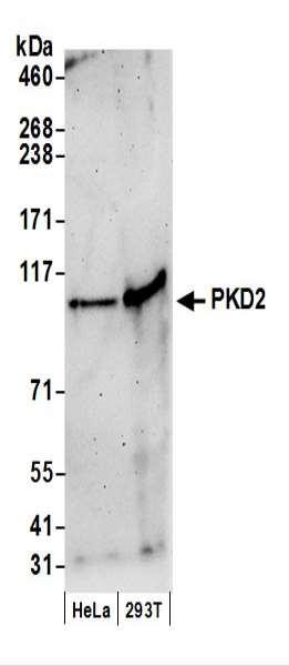 Anti-PKD2