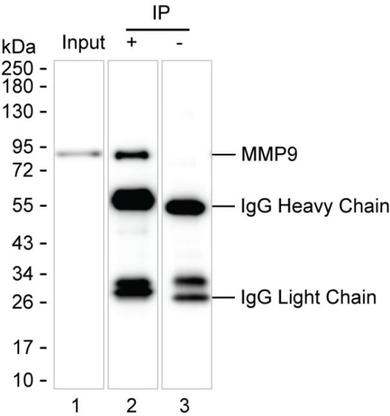 Anti-MMP9