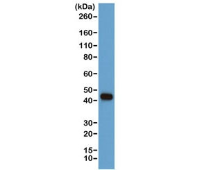 Anti-Beta Actin, clone RM112