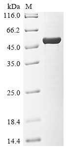 Alpha-1,3-mannosyl-glycoprotein 2-beta-N-acetylglucosaminyltransferase (GNTI), partial, Arabidopsis