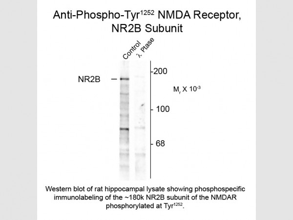 Anti-phospho-NMDA R2B (Thr1252)
