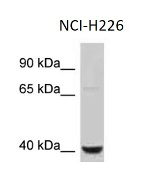 Anti-Cathepsin E