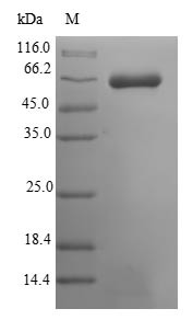 Muscle, skeletal receptor tyrosine-protein kinase (Musk),partial, mouse, recombinant