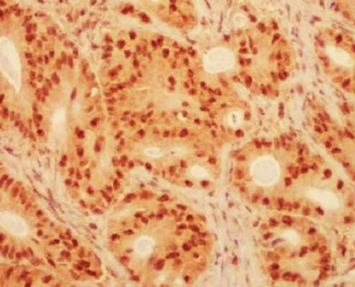 Anti-PI3 Kinase p85 beta