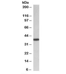 Anti-PCBP1