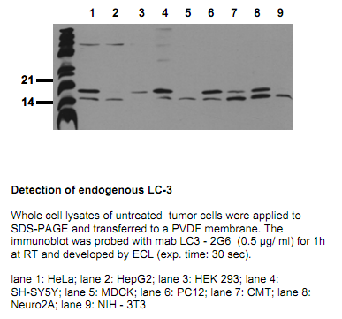 Anti-LC3 B, clone 2G6