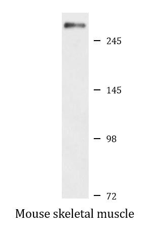 Anti-Dysferlin