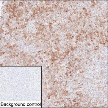 RSPO1 antibody