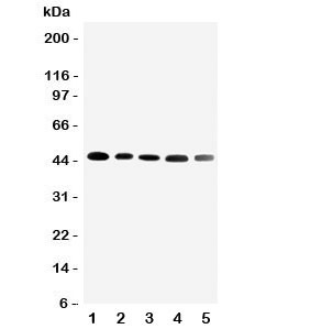 Anti-CBG Cortisol Binding Globulin