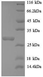 Telomerase protein component 1 (TEP1), partial, recombinant human