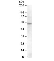 Anti-RPE65