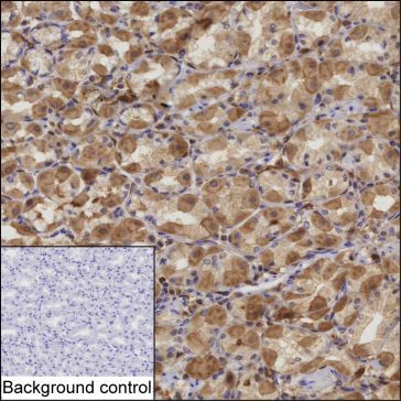 Anti-ALDH3A1