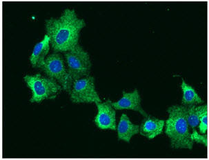 Anti-Epoxide Hydrolase, clone 2E5