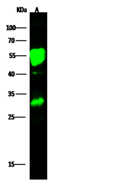 Anti-CCR2/CD192 Polyclonal Antibody