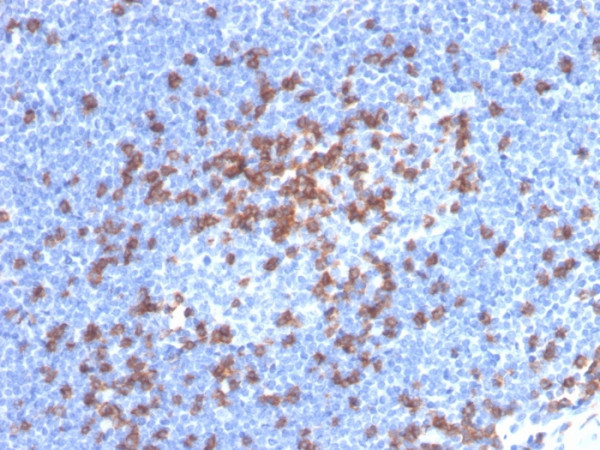 Anti-CD8A (Cytotoxic / Suppressor T-Cell Marker), recombinant antibody, clone CD8/4391R