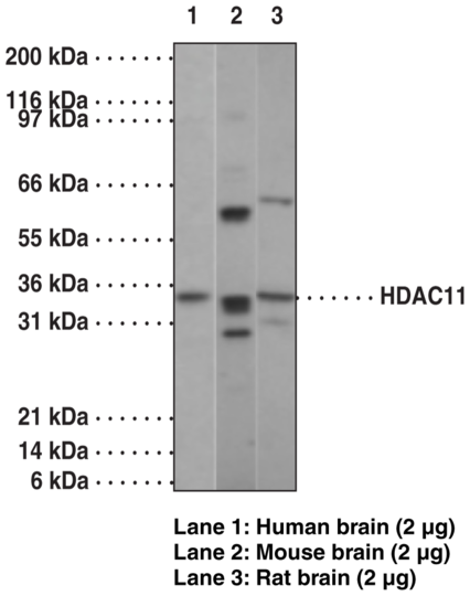 Anti-HDAC11