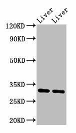 Anti-APOA1