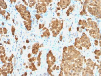 Anti-S100B (Astrocyte and Melanoma Marker) (clone: S100B/1706R) (recombinant rabbit monoclonal)