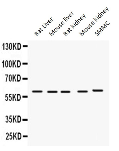 Anti-FMO1