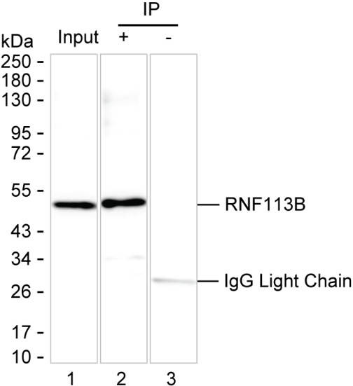 Anti-RNF113B Magnetic Beads