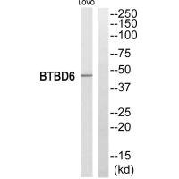 Anti-BTBD6