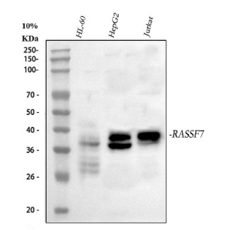 Anti-RASSF7 / Ras association domain-containing protein 7