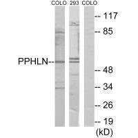 Anti-PPHLN1