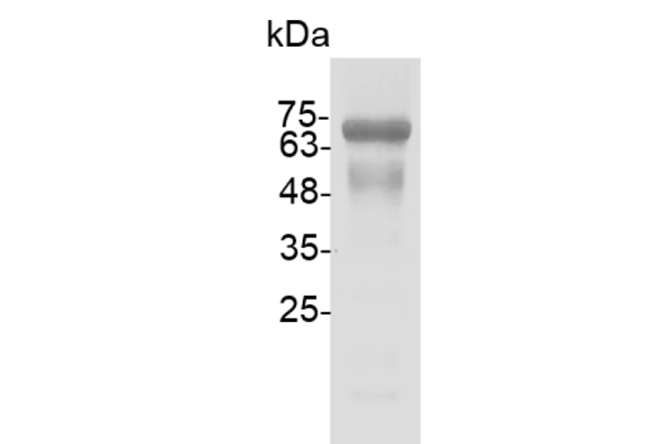 SARS-CoV Nucleocapsid Protein, His-SUMOtag, HEK293