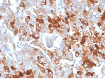 Anti-Clusterin / Apolipoprotein J (APO-J), clone CLU/4727
