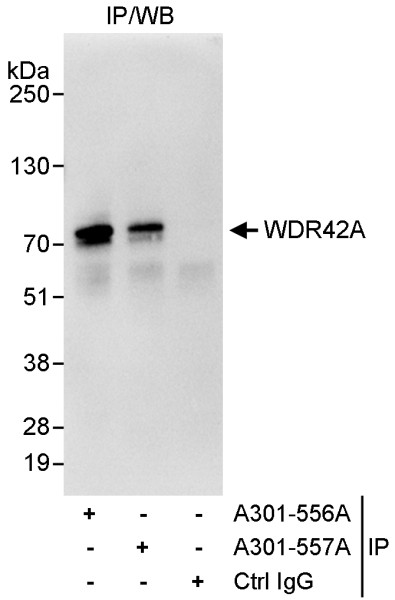 Anti-WDR42A
