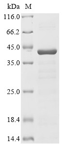Ataxin-2 (ATXN2), partial, human, recombinant