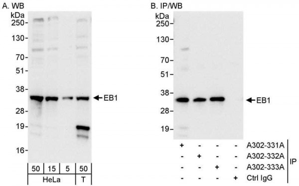 Anti-EB1