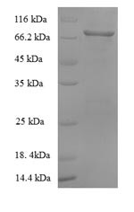 Albumin (ALB), Macaca fascicularis, recombinant