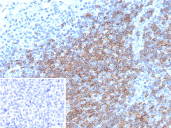 Anti-CD5 (Mantle Cell Lymphoma Marker), recombinant antibody, clone rC5/6976