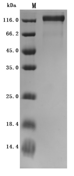 Microtubule-associated protein tau (Mapt) (Active), rat, recombinant