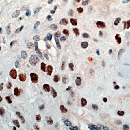 Anti-Cyclin E