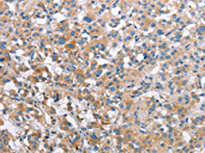 Anti-MCL1
