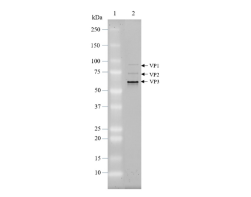 AAV5 Luciferase