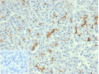 Anti-CFTR (Cystic Fibrosis Transmembrane Conductance Regulator), clone rCFTR/6476