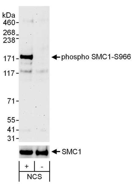 Anti-phospho-SMC1 (Ser966)