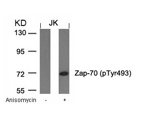 Anti-phospho-Zap-70 (Tyr493)